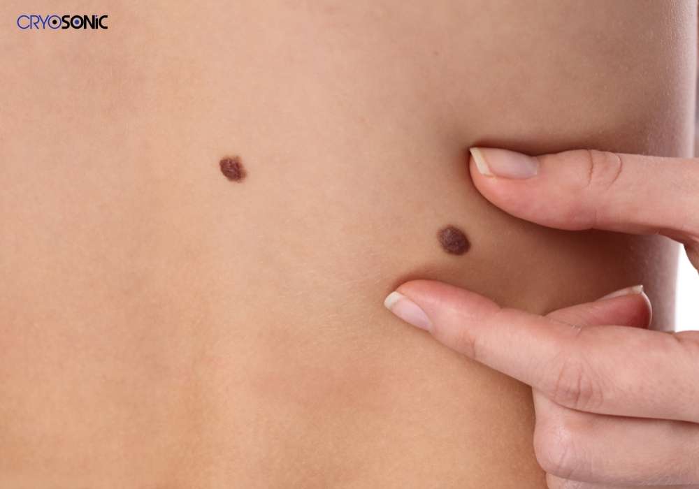 Infection Risk and Poor Aftercare Esher
